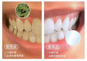 口腔清潔新革命 3秒去除口臭，連打嗝都是薄荷清香