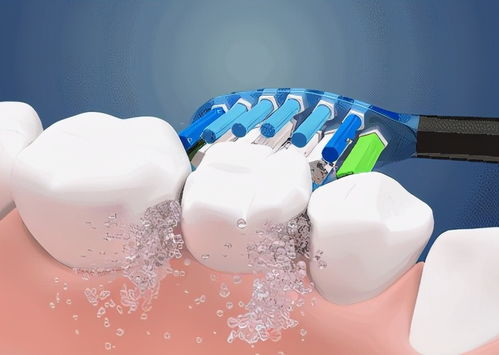 電動牙刷如何選擇 全方位指南，助力牙齒清潔健康