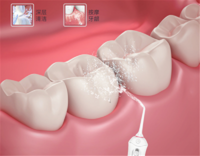 家庭口腔清潔新寵 為何這個(gè)品牌正悄然超越潔碧，成為水牙線首選
